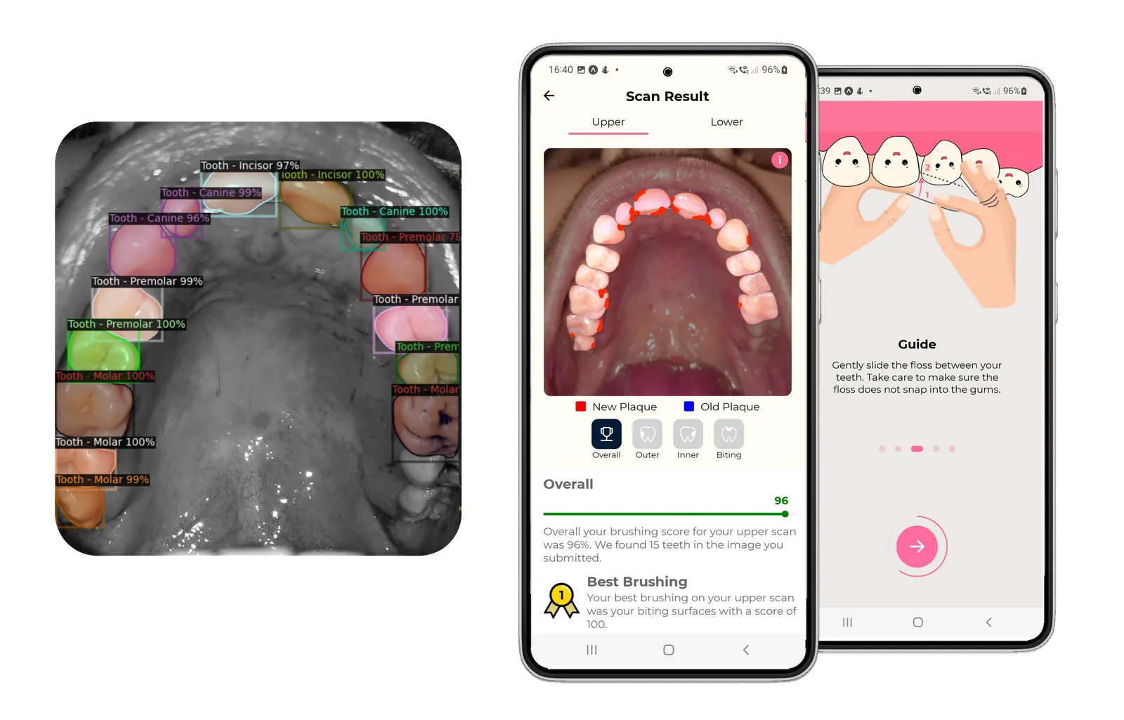 The Testmyteeth AI dental app and its custom tooth detection model labelling each tooth in a scan